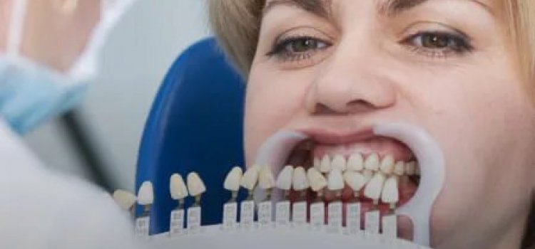 Şirinevler’de İmplant Muayenesine Giderken Hangi Sorular Sorulmalı?